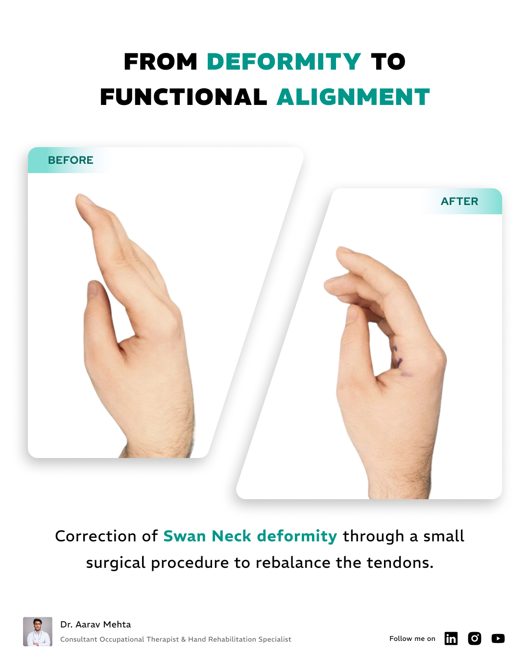 Posters Design - Sample 2 - After